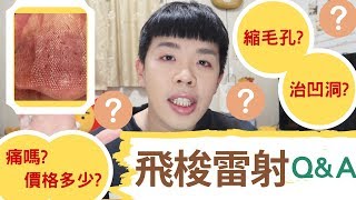 台中飛梭雷射 台中型男co2飛梭雷射改善毛孔痘疤 台中co2飛梭雷射推薦台中co2飛梭雷射體驗價台中co2飛梭雷射術後保養台中co2飛梭雷射 診所台中co2飛梭雷射價格台中co2飛梭雷射效果台中co2飛梭雷射保養