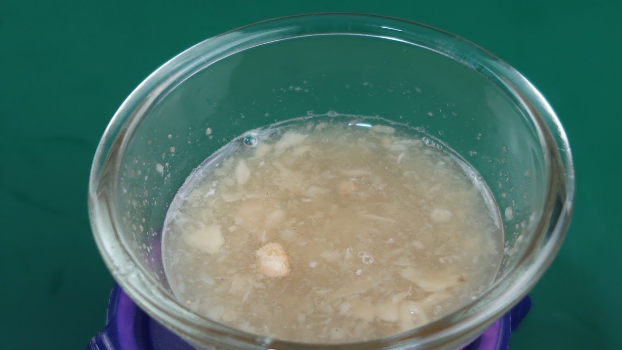 varicoză de crampe colanți pentru venele varicoase ajută sau nu