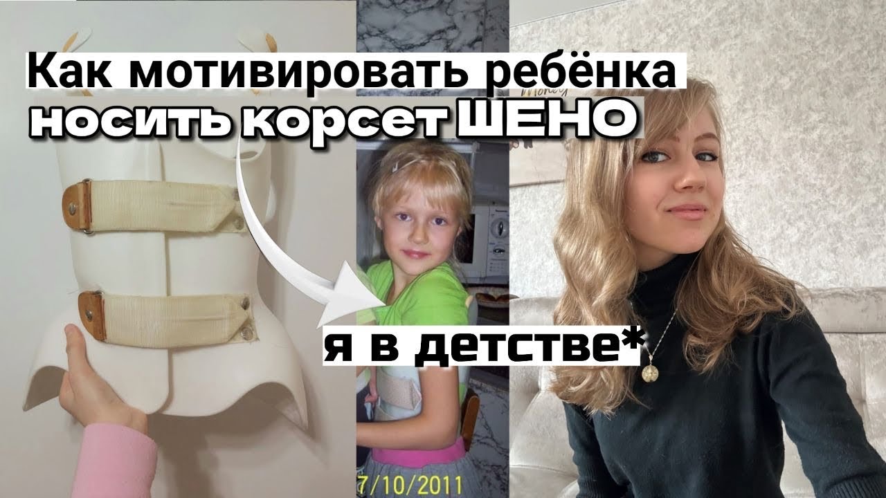 КАК МОТИВИРОВАТЬ РЕБЁНКА НОСИТЬ КОРСЕТ ШЕНО? И делать ЛФК #корсет #корсетшено 