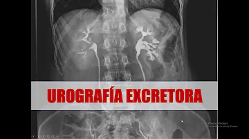 Quanto dura Urografia?