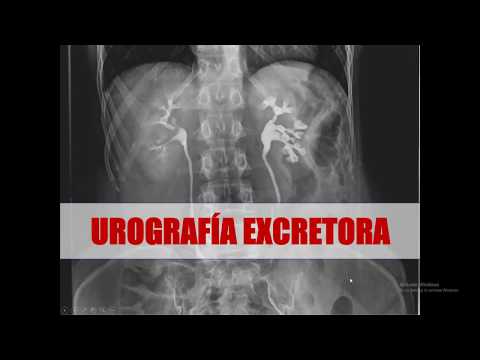 Vídeo: Per què es fa un pielograma?