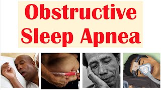 Obstructive Sleep Apnea Osa Risk Factors Signs Symptoms Complications Diagnosis Treatment