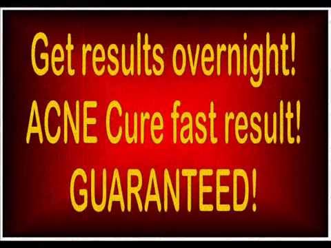 Get results overnight! ACNE CURE fast result GUARANTEED!