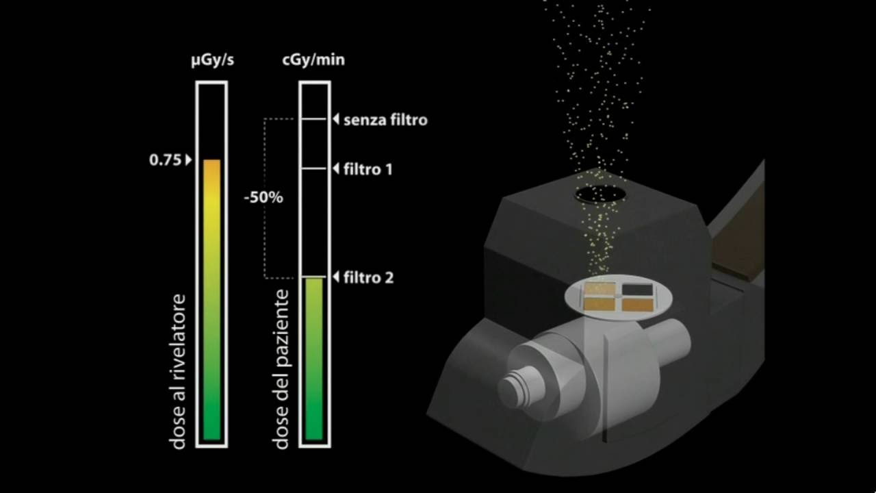 Radioprotezione per tecniche interventistiche