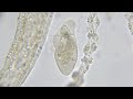ヒドラの毒針で細胞崩壊したゾウリムシ