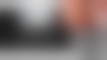 Transscaphoid Perilunate dislocation