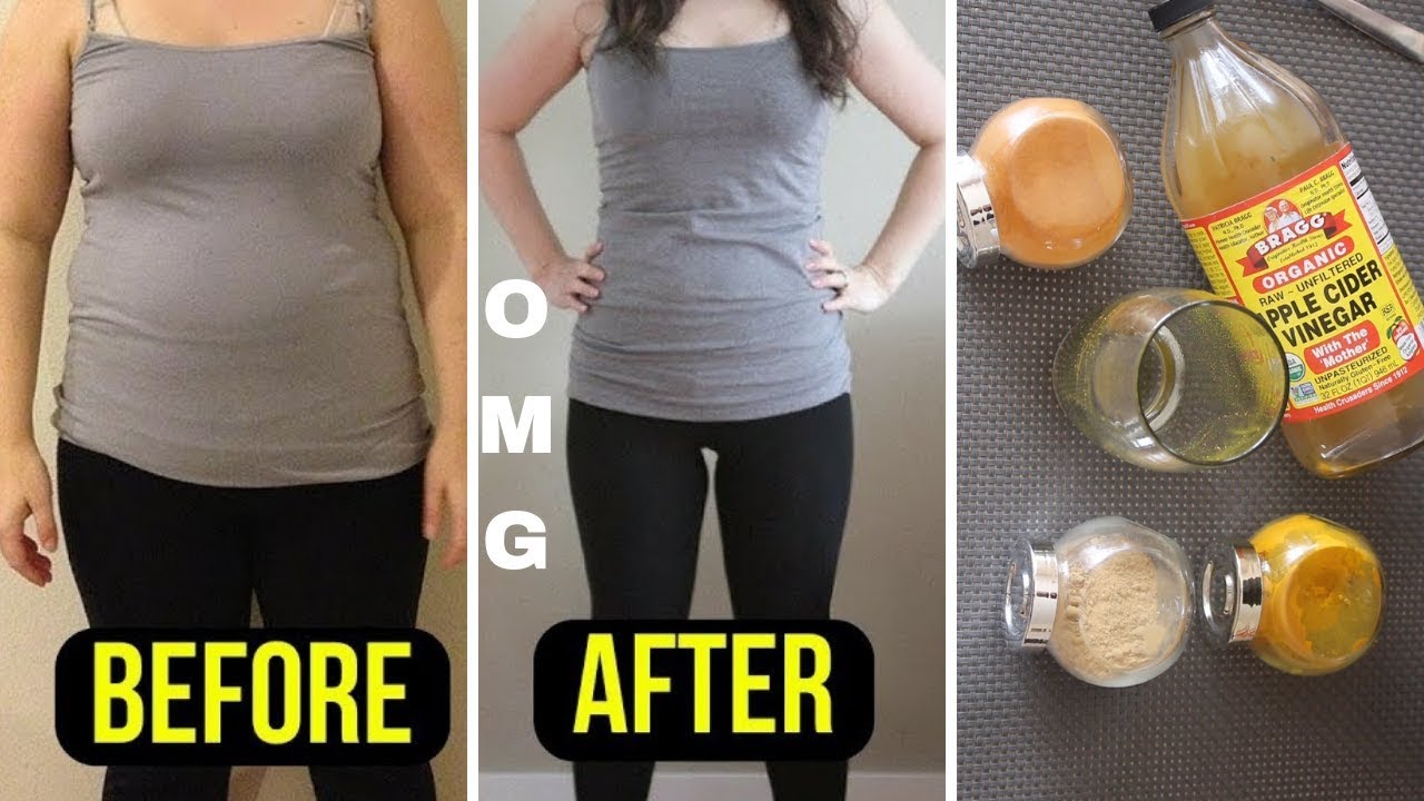 Add These In Your Apple Cider Vinegar For 7 Days And Lost Weight Like