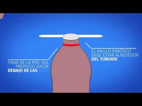 crema corticoides para fimosis adultos crema corticoides para fimosis adultos