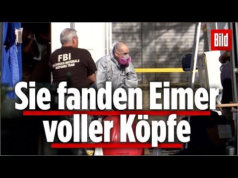 Video: In Einem 15-jährigen Teenager Wurde Sein Parasitenbruder Mit Kopf, Beinen Und Genitalien Gefunden - Alternative Ansicht