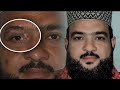 Eyes Facture and Remove Dark Pimpale in Photoshop cc in