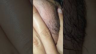 ASMR Relaxing beard hair Satisfying #massage #ingrownhair #haircare #shorts #video #scratch #sound