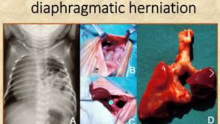 Clinical correlations of the respiratory system