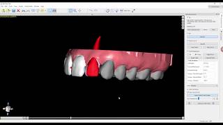 Phase 4 - Tooth Alignment screenshot 2