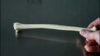 SKELETAL SYSTEM ANATOMY: Bones of the forearm- Radius