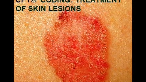 CPT® coding for Skin Lesions