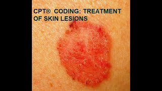 CPT® coding for Skin Lesions