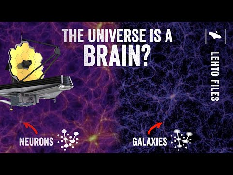 The universe is a brain- James Webb telescope will be the key 