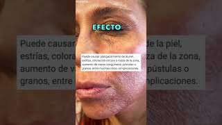 BARMICIL ¿Lo debo usar constantemente? | BIUTEST