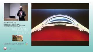 History and Pathology of Intraocular Lens Implants [ARCHIVE] screenshot 3