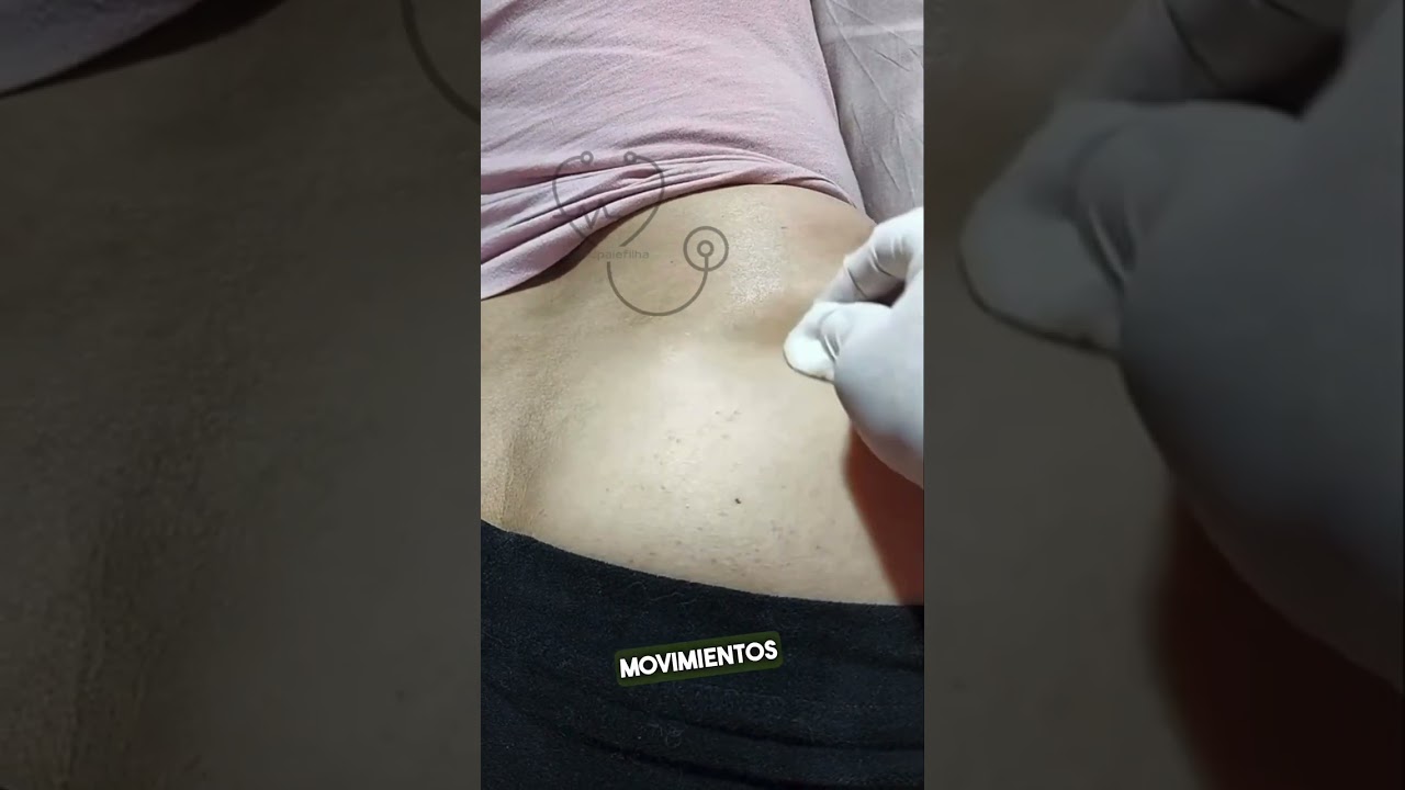 Técnica INTRAMUSCULAR em Z #shorts