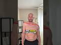 How To FIX Uneven Shoulders For Good