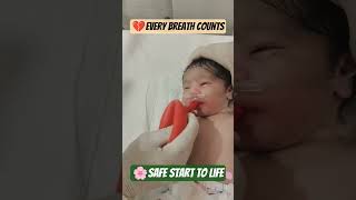 💙 Newborn’s First Breath: How to Use Bulb Syringe to Clear Baby’s Mouth & Nose #baby #BulbSucker 💙 Newborn’s First Breath: How to Use Bulb Syringe to Clear Baby’s Mouth & Nose #baby #BulbSucker