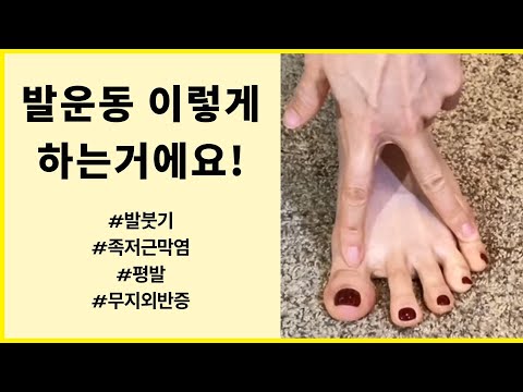 발운동 이것만 하세요!! 무릎통증 줄여주는 발운동
