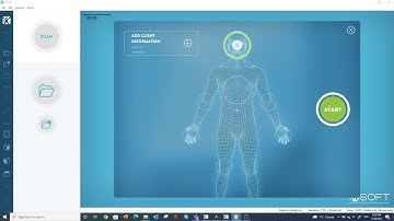 Head scan with MSoft and the EinScan H scanner
