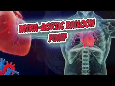 Intra aortic balloon pump - Human Heart ❤️ and Cardiology ❤️🔊✅