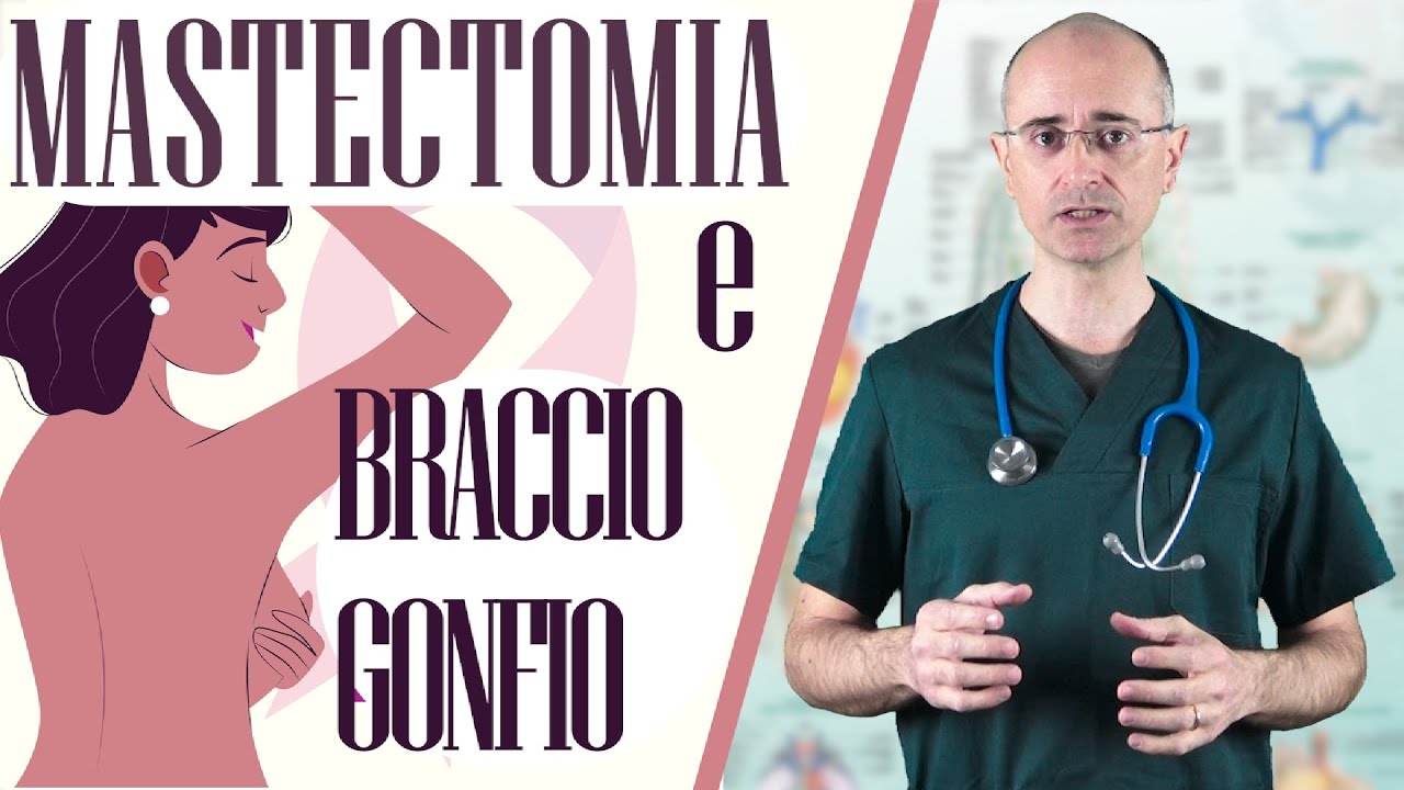 Mastectomia e Braccio Gonfio