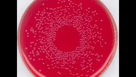Como é feita a análise de Salmonella?
