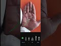 मेडिकल योग#astrology #rishabhjithepalmist #palmistry #fortunetelling