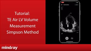 Mindray Te Air Tutorial - Lv Volume Measurement Simpson Method