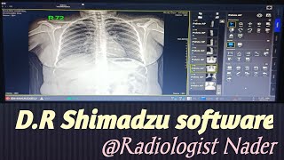 شرح مبسط لسوفت وير جهاز دي آر شيمادزو|DR   . Shimadzu screenshot 1