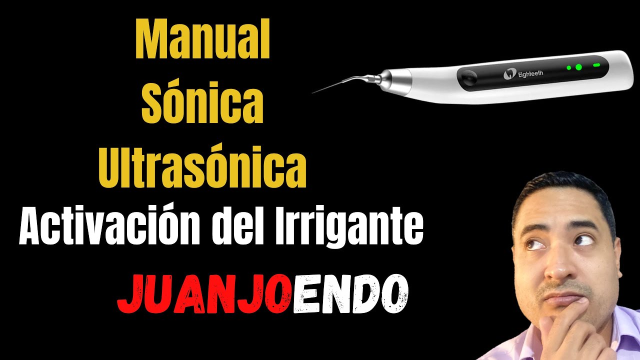 Activación de los Irrigantes. Manual- Sónica y Ultrasónica.