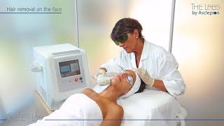 Pronto Plus | Affordable Hair Removal for the Modern Med Spa.