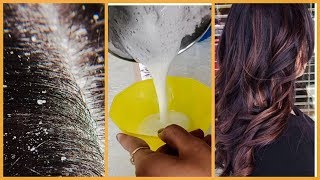 Winter hair care for dandruff remove and stop fall thanks watching
🙏 hope you like this video
💖💖💖💖💖💖💖💖💖💖💖💖💖💖💖💖💖💖
products link i used 👇 👉go...
