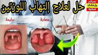الدكتور محمد الفايد علاج إلتهاب اللوزتين بالطريقة الصحيحة