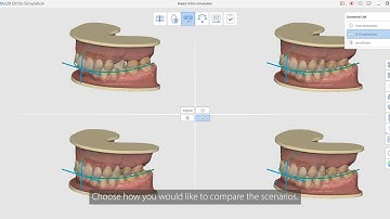 Medit Ortho Simulation [Subtitles Available]