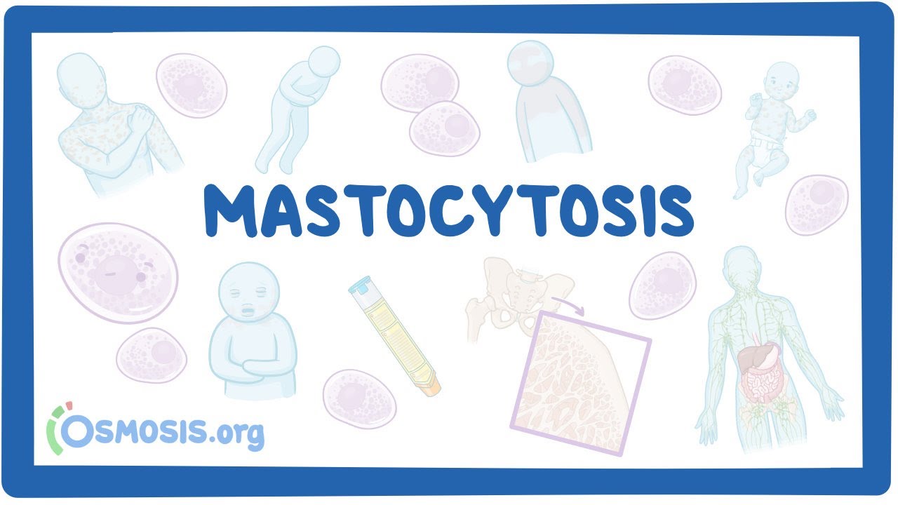 Mastocytosis (NORD)