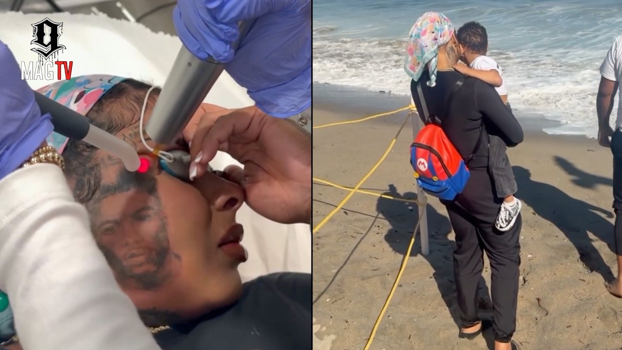 🔥Chrisean Rock Goes In For Her 2nd Tattoo Removal Session On Father’s Day!  Chrisean Rock has officially started her intense second laser tattoo removal session