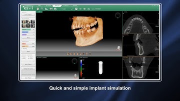 Vatech  Ez3D i Introduction Video