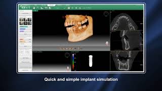 Vatech  Ez3D i Introduction Video
