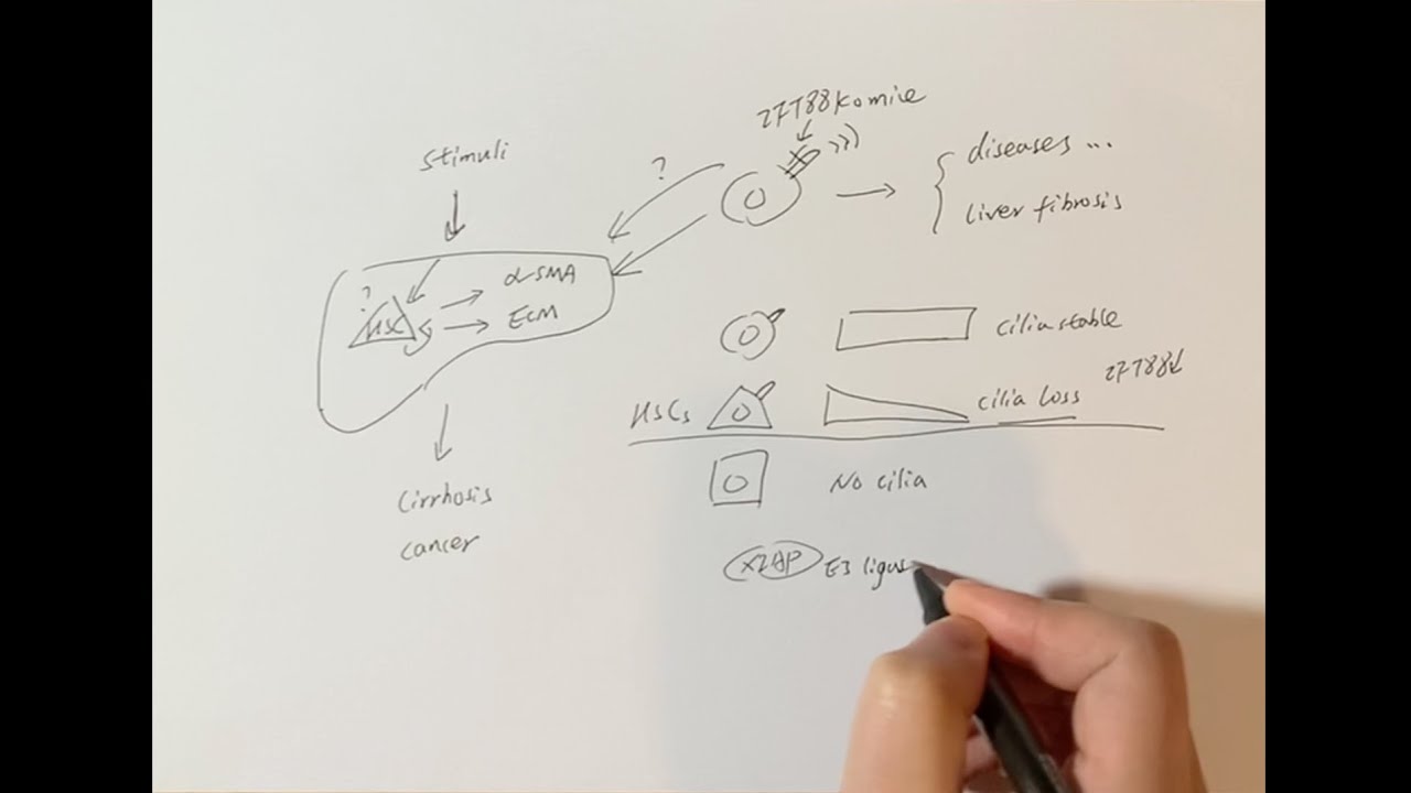 Video synopsis: XIAP-IFT88 axis promotes liver fibrosis (EMBO Reports)