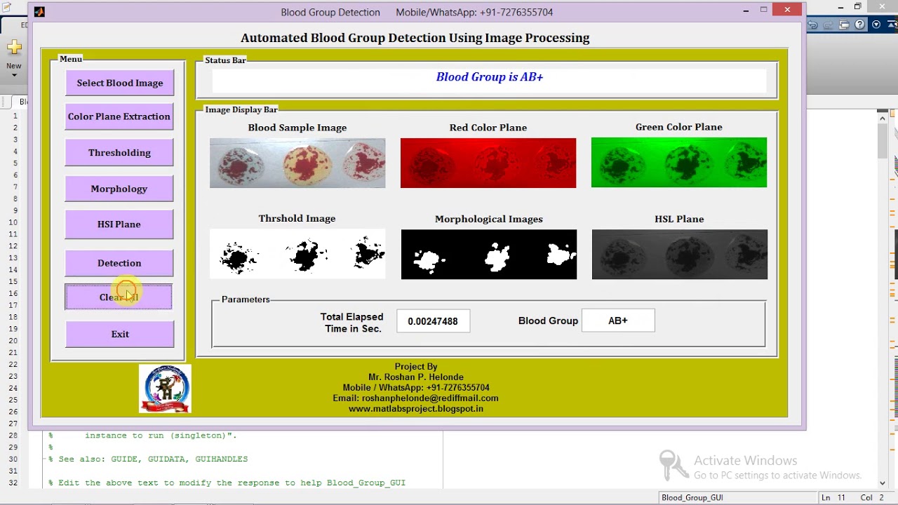 Matlab code for Blood Group Detection Using Image Processing - YouTube