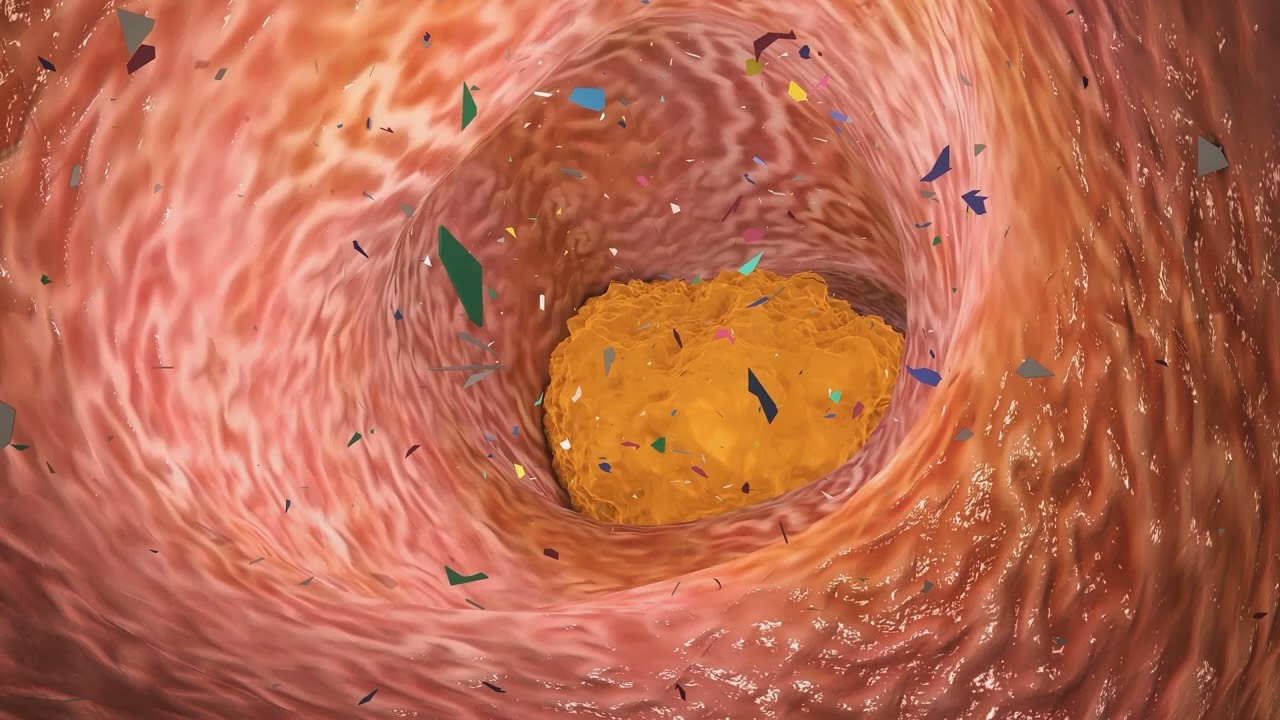 How Much Plastic Do We Eat? You’re Eating A Credit Card’s Worth of