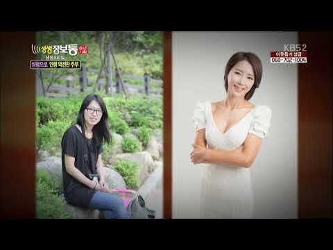 성형으로 인생 역전한 주부 박화성