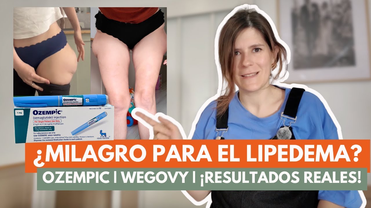 semaglutide for lipedema ¿Puede OZEMPIC ELIMINAR el Lipedema? 🤔