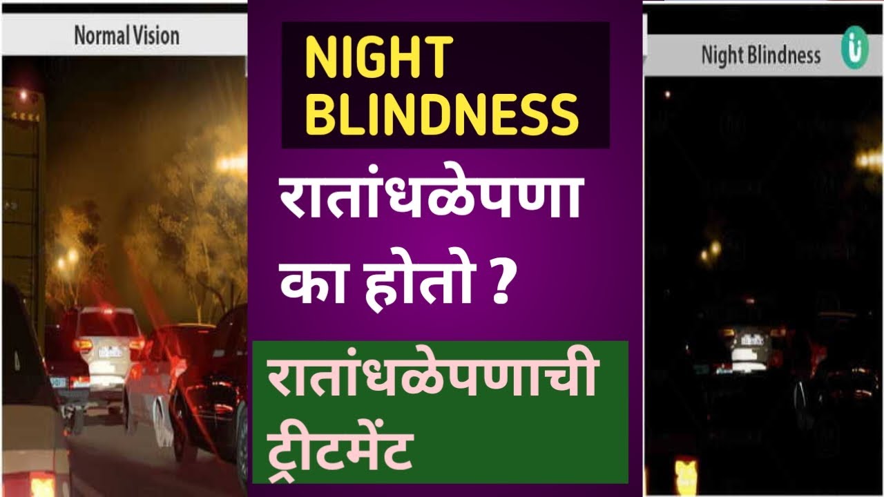 रातांधळेपणा का होतो । Night blindness in Marathi । Marathi solution