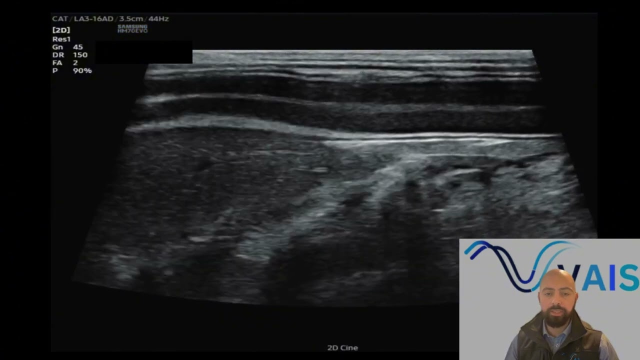 How to Ultrasound the Canine Pancreas | Step-by-Step Scanning Technique with Dr Stefano Ludovici